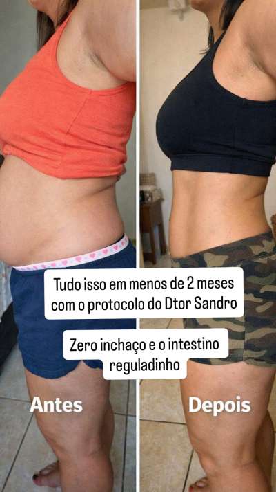 Antes e Depois